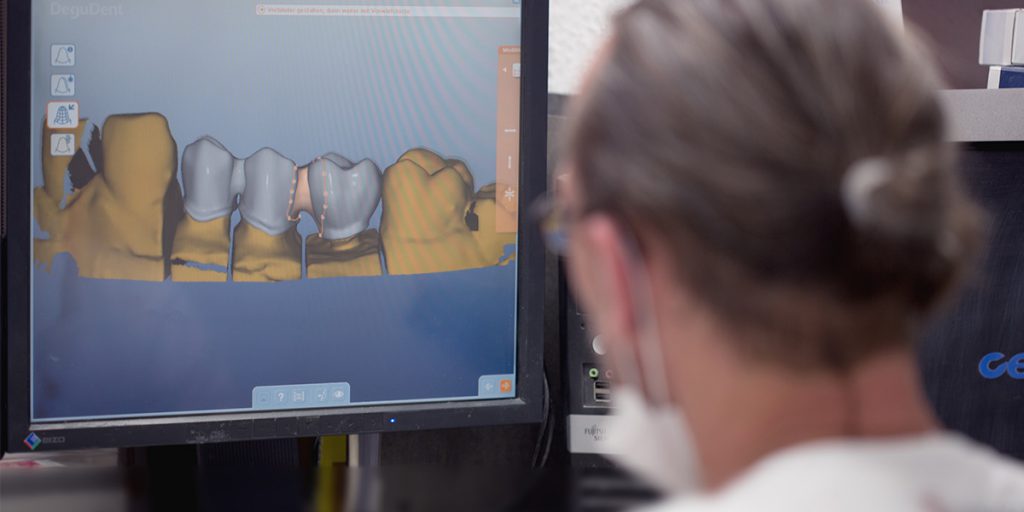 Vollkeramische Restauration Dr. Pantas Düsseldorf