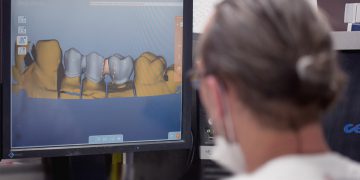 vollkeramische-zahn-restauration | Dr. Pantas Zahnrestauration