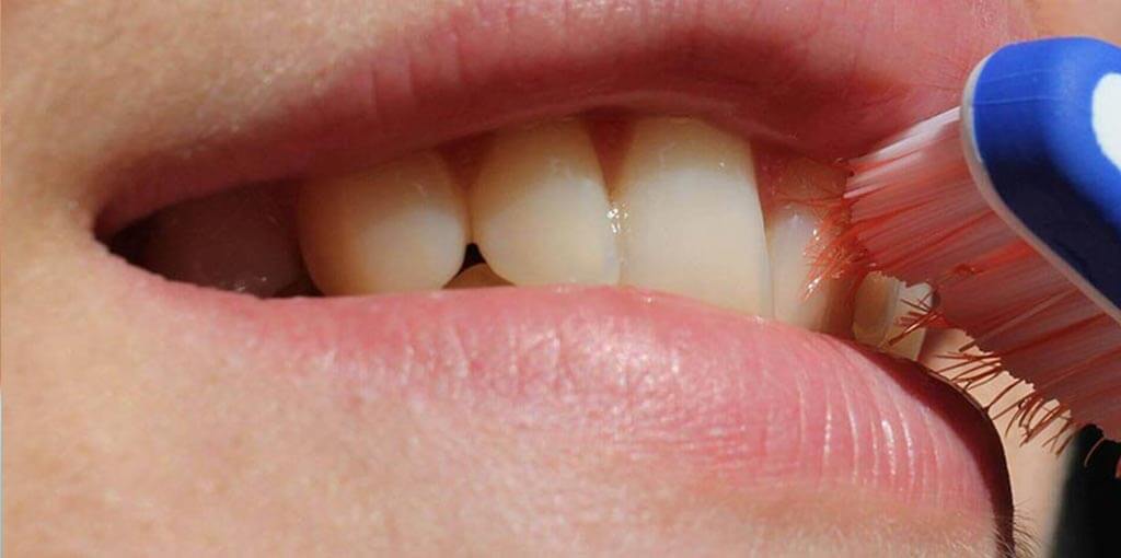 Mundgeruch - was tun? | Dr. Pantas Mundgeruch