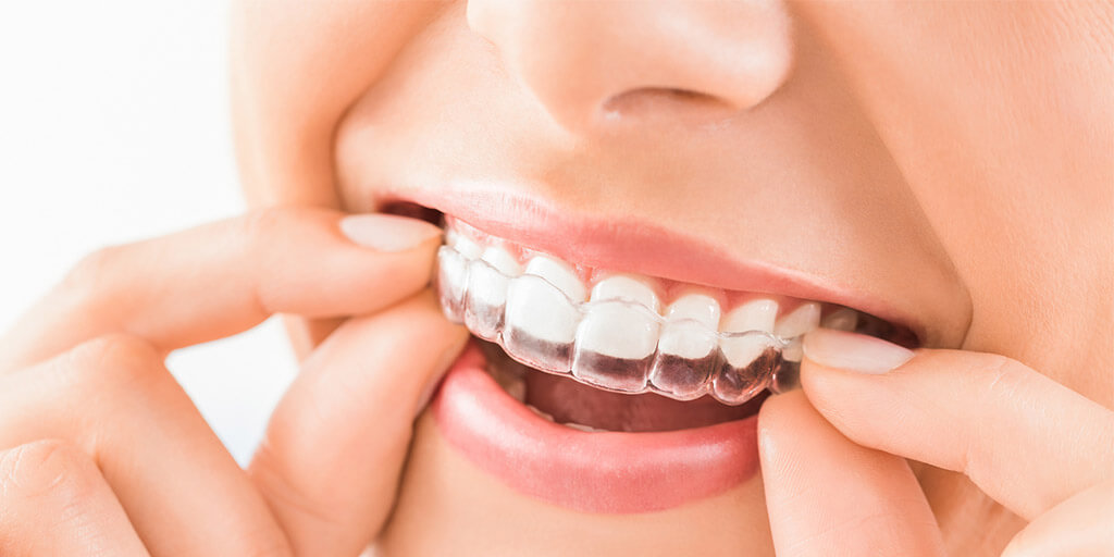 Kinderzahnarzt in Düsseldorf