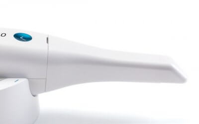 Intraorales Scannen – Der Würgereflex gehört der Vergangenheit an