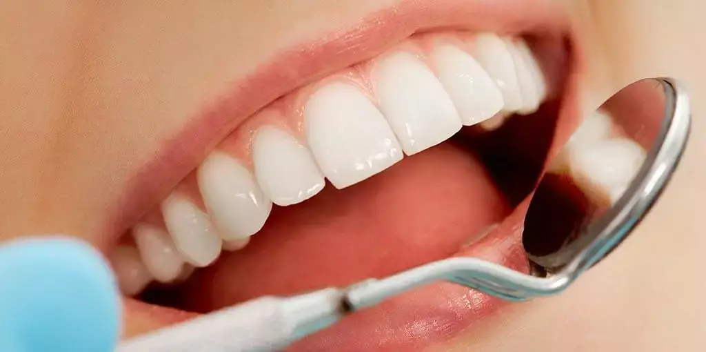 Veneers Düsseldorf | Dr. Pantas Veneers Düsseldorf